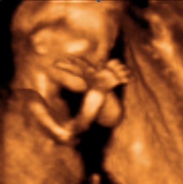 16 weeks baby 3d 4d ultrasound living images fort walton beach ultrasound