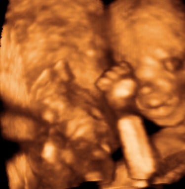 20 weeks baby 3d 4d ultrasound living images fort walton beach ultrasound
