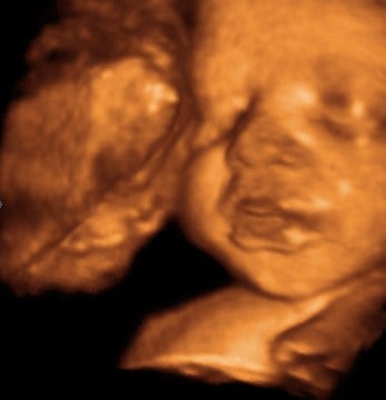 31 weeks baby 3d 4d ultrasound living images fort walton beach ultrasound