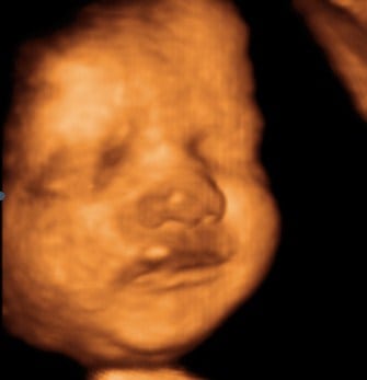 3d 4d baby ultrasound living images fort walton beach ultrasound