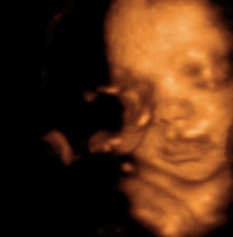 3d 4d ultrasound baby ultrasound living images fort walton beach ultrasound