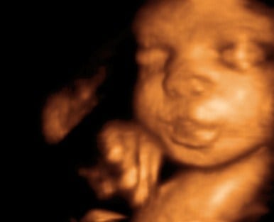 3d 4d ultrasound baby ultrasound living images in fort walton beach ultrasound