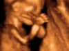 16 weeks baby 3d 4d ultrasound living images fort walton beach ultrasound