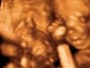 20 weeks baby 3d 4d ultrasound living images fort walton beach ultrasound