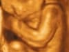 23 weeks baby 3d 4d ultrasound living images fort walton beach ultrasound