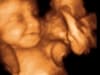 27 weeks baby 3d 4d ultrasound living images fort walton beach ultrasound