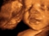 31 weeks baby 3d 4d ultrasound living images fort walton beach ultrasound