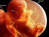 3d-4d-HD-4K-8K-ultrasound-fort-walton-beach-destin-pensacola-shalimar-florida-12-week-fetus