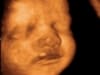 3d 4d baby ultrasound living images fort walton beach ultrasound