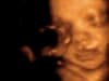 3d 4d ultrasound baby ultrasound living images fort walton beach ultrasound