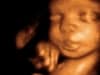 3d 4d ultrasound baby ultrasound living images in fort walton beach ultrasound