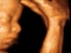 3d 4d ultrasound fort walton beach