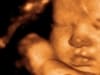 3d 4d ultrasound niceville florida fl