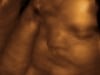 3d 4d ultrasound fort walton beach, niceville, pensacola, navarre, crestview, Eglin, Hurlburt, AFB