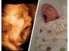 baby-yawn-3d-ultrasound-fort-walton-beach