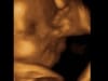 3d 4d ultrasound fort walton beach, niceville, pensacola, navarre, crestview, Eglin, Hurlburt, AFB