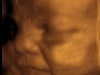 3d 4d ultrasound fort walton beach, niceville, pensacola, navarre, crestview, Eglin, Hurlburt, AFB