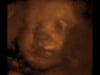 3d 4d ultrasound fort walton beach, niceville, pensacola, navarre, crestview, Eglin, Hurlburt, AFB