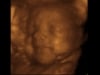 3d 4d ultrasound fort walton beach, niceville, pensacola, navarre, crestview, Eglin, Hurlburt, AFB