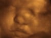 3d 4d ultrasound fort walton beach, niceville, pensacola, navarre, crestview, Eglin, Hurlburt, AFB