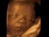 3d 4d ultrasound fort walton beach, niceville, pensacola, navarre, crestview, Eglin, Hurlburt, AFB