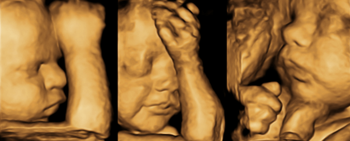 3d-4d-baby-ultrasound-fort-walton-niceville