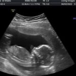 Gender-reveal-3d-4d-living-images-fort-walton-fl