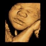 3d 4d ultrasound fort walton beach-meet-me 30 weeks